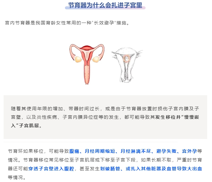 微信截图_20250307091817.png